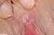 SUZUKO 2|#158