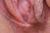 MINE|#156