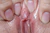SUZUNE|#155